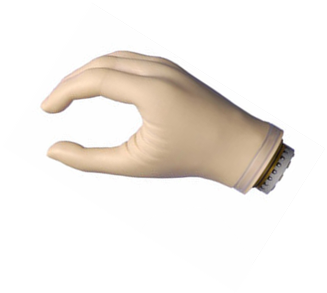 假肢廠家安裝手指假肢時會遇到哪種問題(圖1) 假肢廠家安裝手指假肢時會遇到哪種問題(圖1)